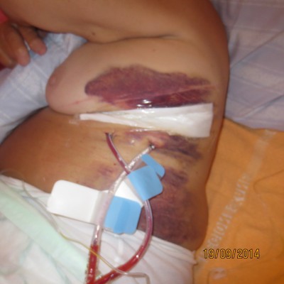 Image Thumbnail