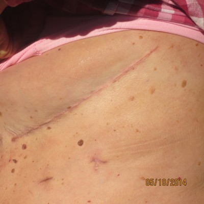 Image Thumbnail